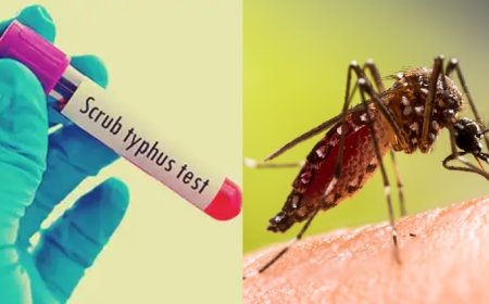 दाङमा स्क्रब टाइफस र डे‌गुका बिरामीकाे संख्या बढ्दाे ।