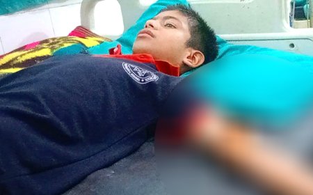 अर्घाखाँचीमा बाँदरकाे आक्रमणमा एक  विद्यार्थी घाइते ।